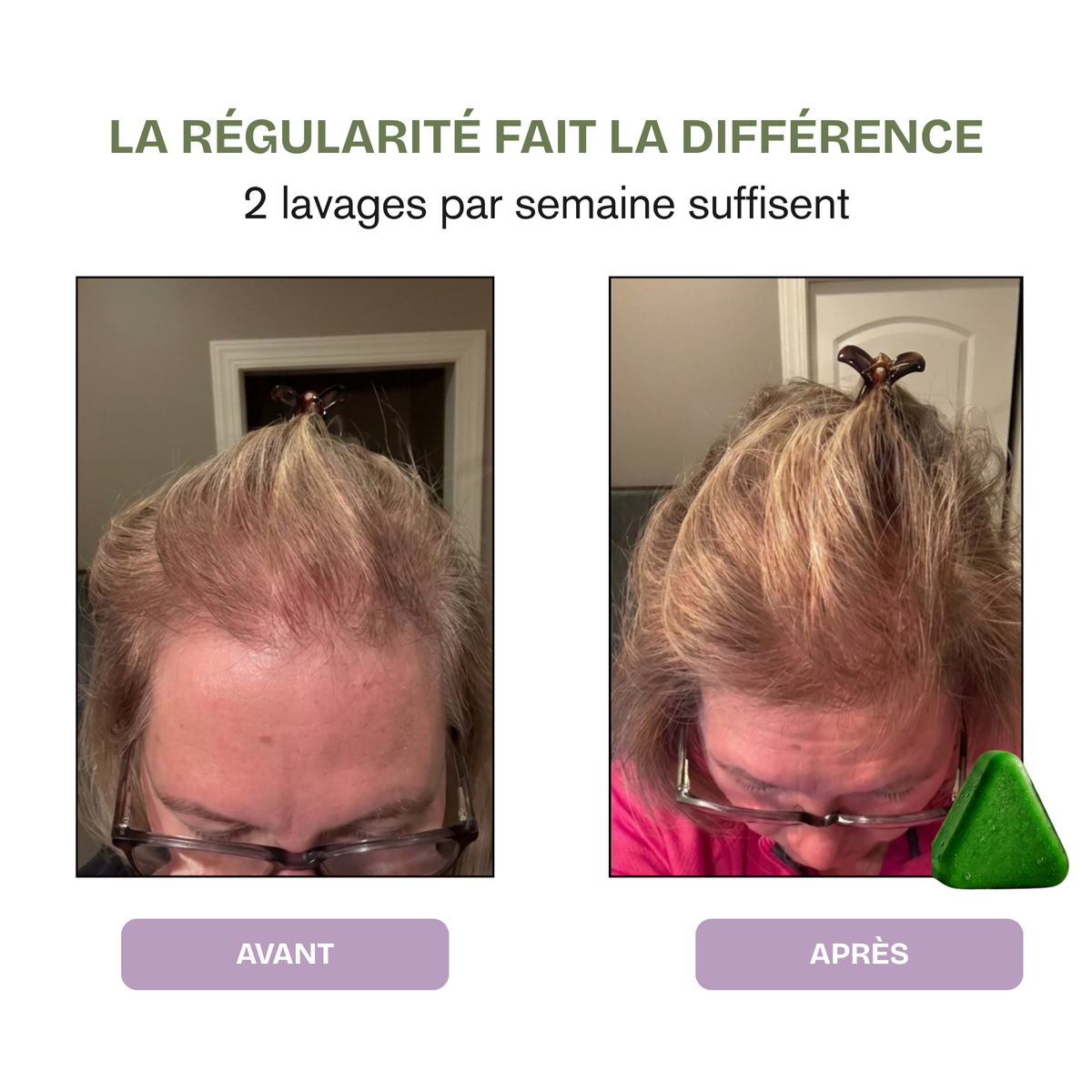 Shampoing Rituel Coréen Anti-Chute